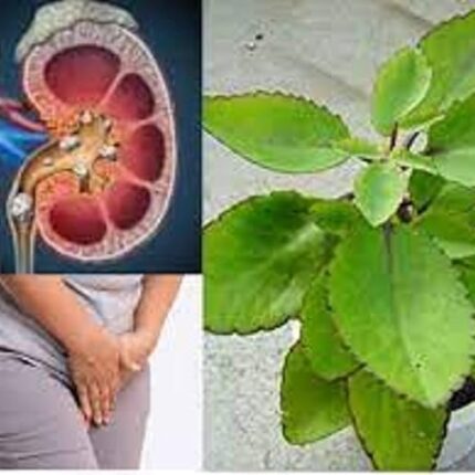 Shrisha Herbal Patharchatta Tablets-60 Tablets Pack. Pure Natural.